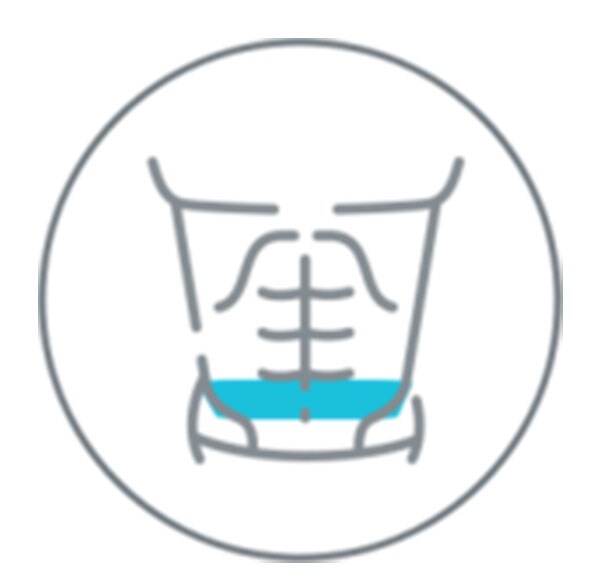 Transverso del abdomen Transverso del abdomen
