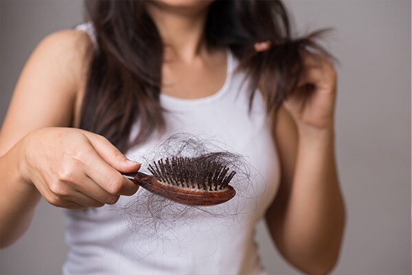 Caída del cabello Caída del cabello