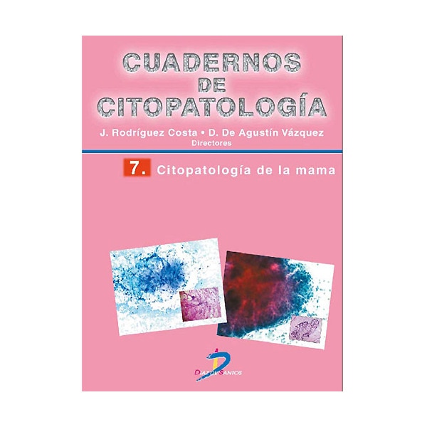 Imagem 0 de Citopatología de la máma: Cuadernos de citopatologia-7 (Capa mole)