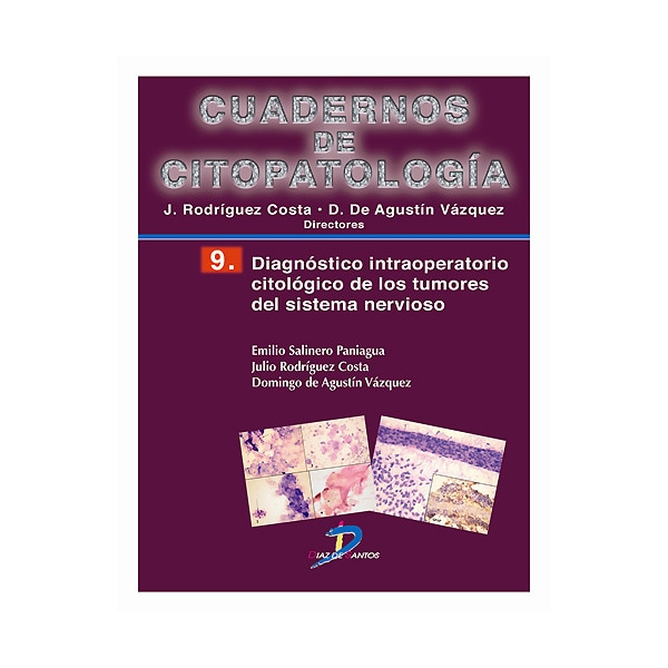 Diagnóstico intraoperatorio citológico de los tumores del sistema nervioso. Cuadernos de Citopatología nº 9 (Capa mole) 1