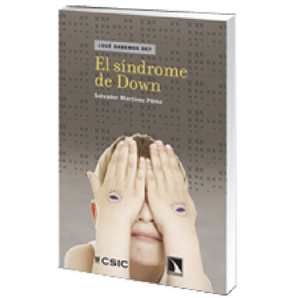 El Síndrome De Down 1