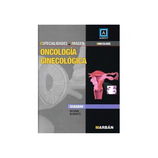 Imagen 0 de Oncologia Ginecologica