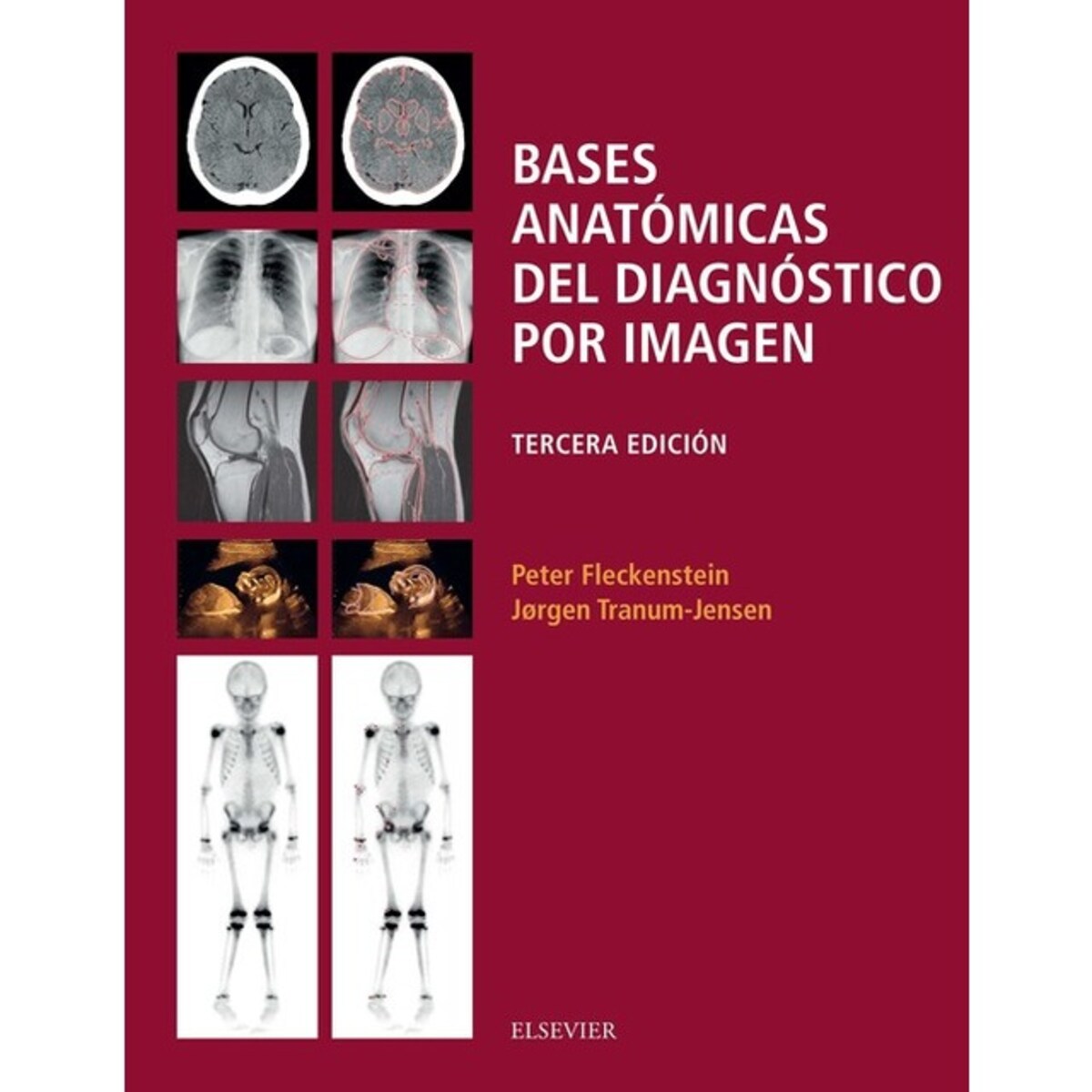 Bases anatómicas del diagnóstico por imagen  (Tapa blanda) 1