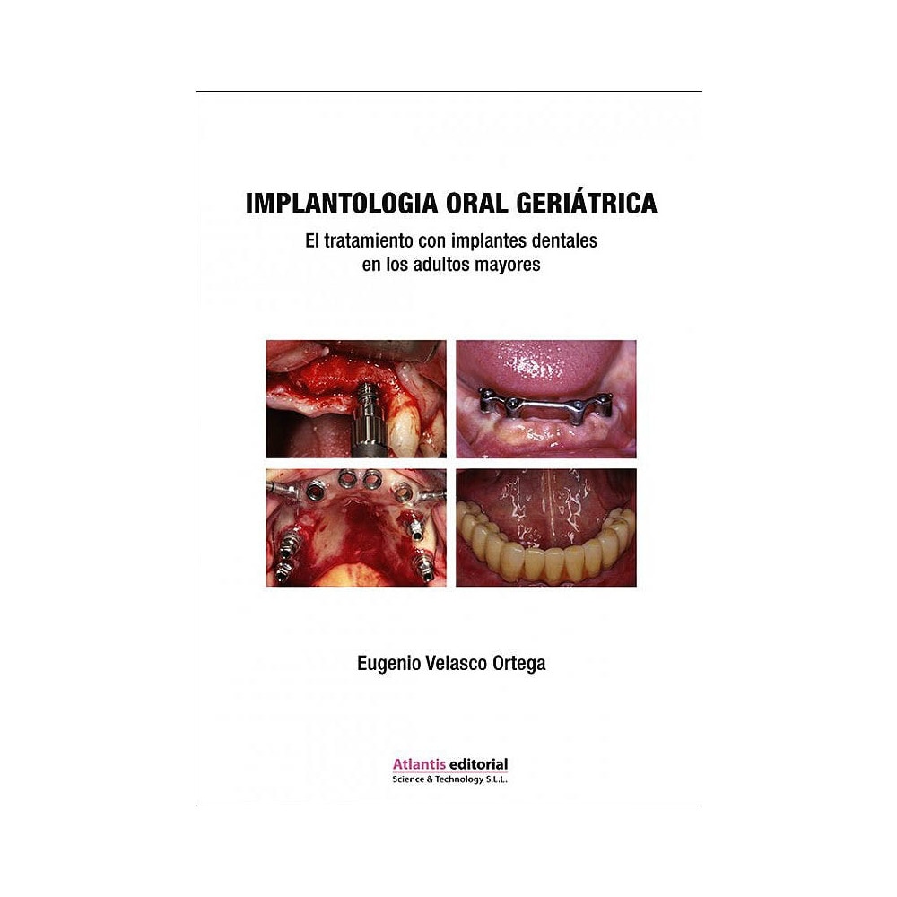 Imagen 0 de Implantología Oral Geriátrica. El Tratamiento con Implantes Dentales en los Adultos Mayores