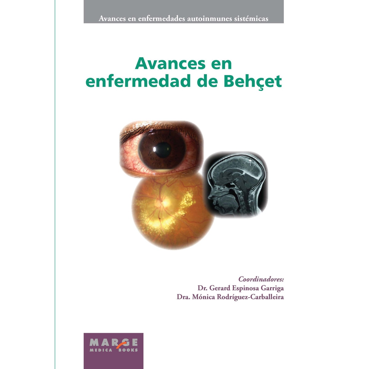 Avances en enfermedad de Behçet (Capa dura) 1