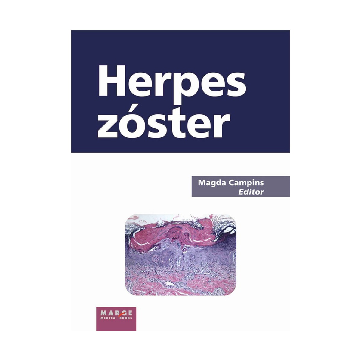 Herpes zóster(Tapa dura) 1