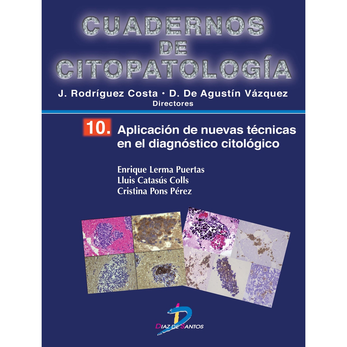 Imagem 0 de Aplicación de nuevas técnicas en el diagnóstico citológico: Cuadernos de citopatologia-10 (Capa mole)