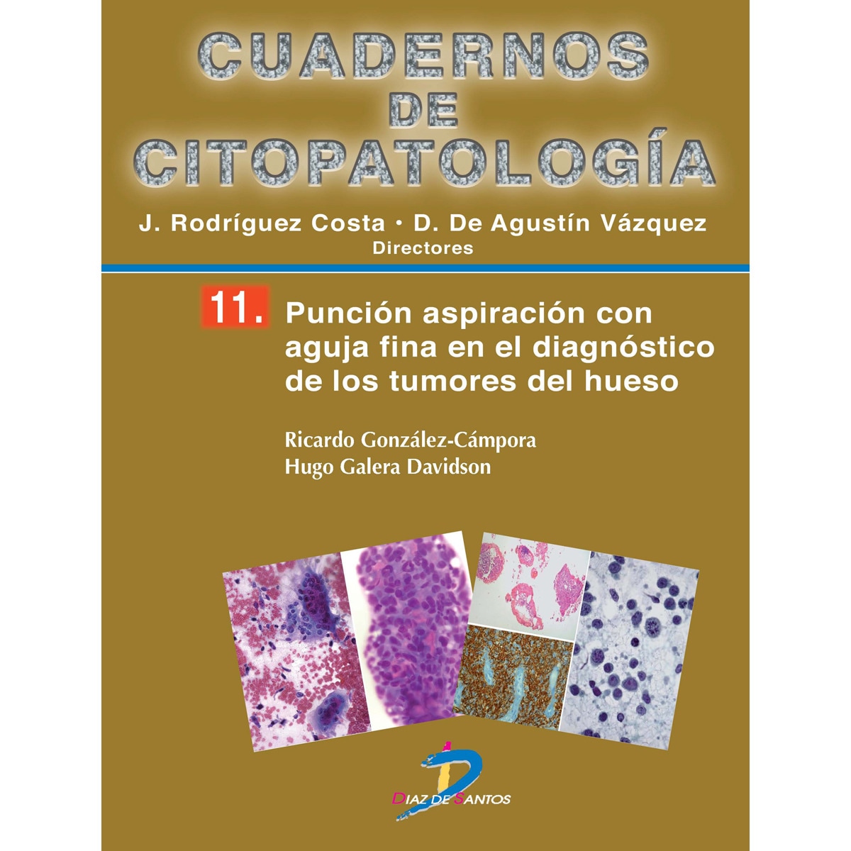 Imagem 0 de Punción aspiración con aguja fina en el diagnósitco de los tumores de los tejidos blandos: Cuadernos de citopatologia-8 (Capa mole)