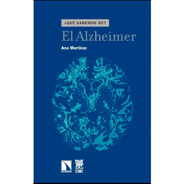 Imagen 0 de El alzheimer