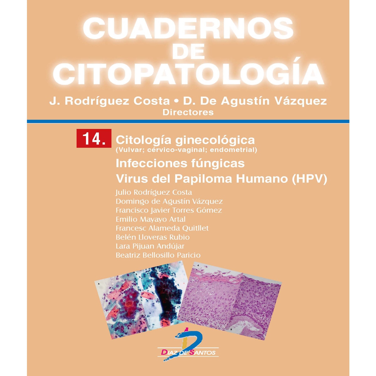 Imagem 0 de Citología Ginecológica: Infecciones Fúngicas. Virus