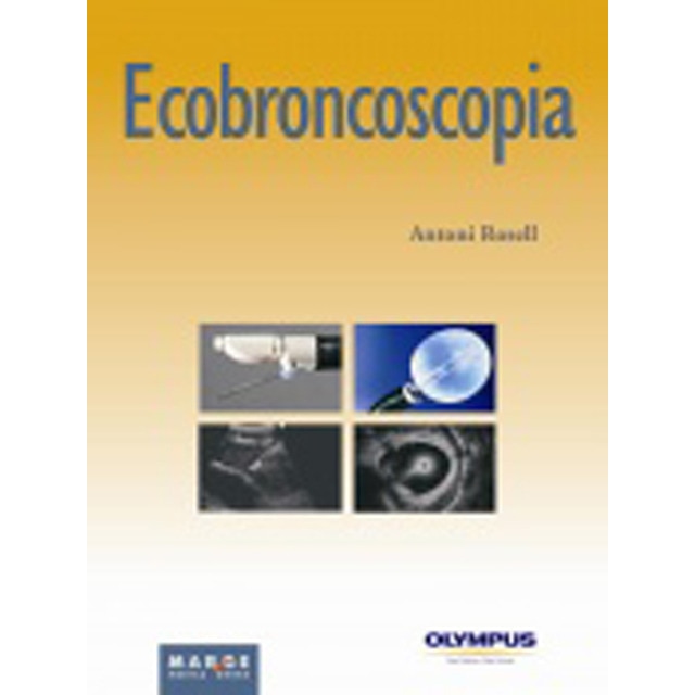Ecobroncoscopia(Tapa blanda) 1