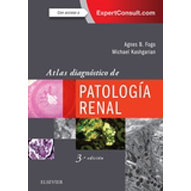 Imagem 0 de Atlas diagnóstico de patología renal (Capa mole)