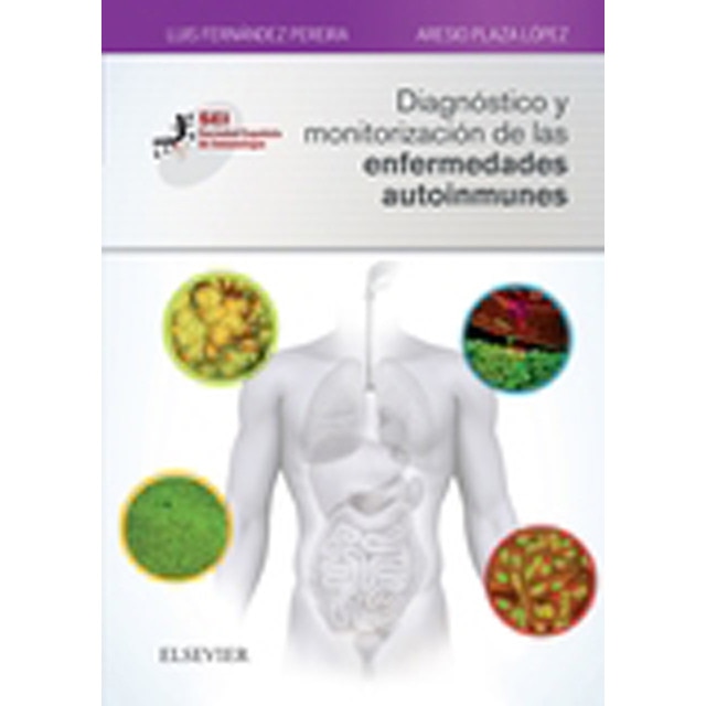 Diagnóstico y monitorización de las enfermedades autoinmunes: Sociedad Española de Inmunología (Capa mole) 1