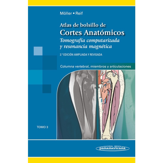 Imagen 0 de Atlas cortes anatomicos, 2aEd T3: Tomo 3. Tomografía computarizada y resonancia magnética: Columna vertebral, Miembros y Articulaciones