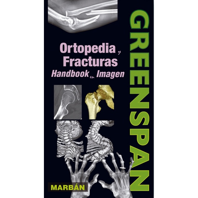 Imagem 0 de Ortopedia Y Fracturas En Imagen