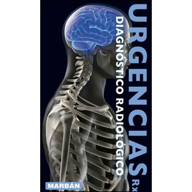 Imagem 0 de Urgencias Rx: Diagnóstico Radiológico