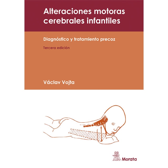 Imagem 0 de Alteraciones motoras cerebrales infantiles: DIAGNÓSTICO Y TRATAMIENTO PRECOZ (Capa mole)