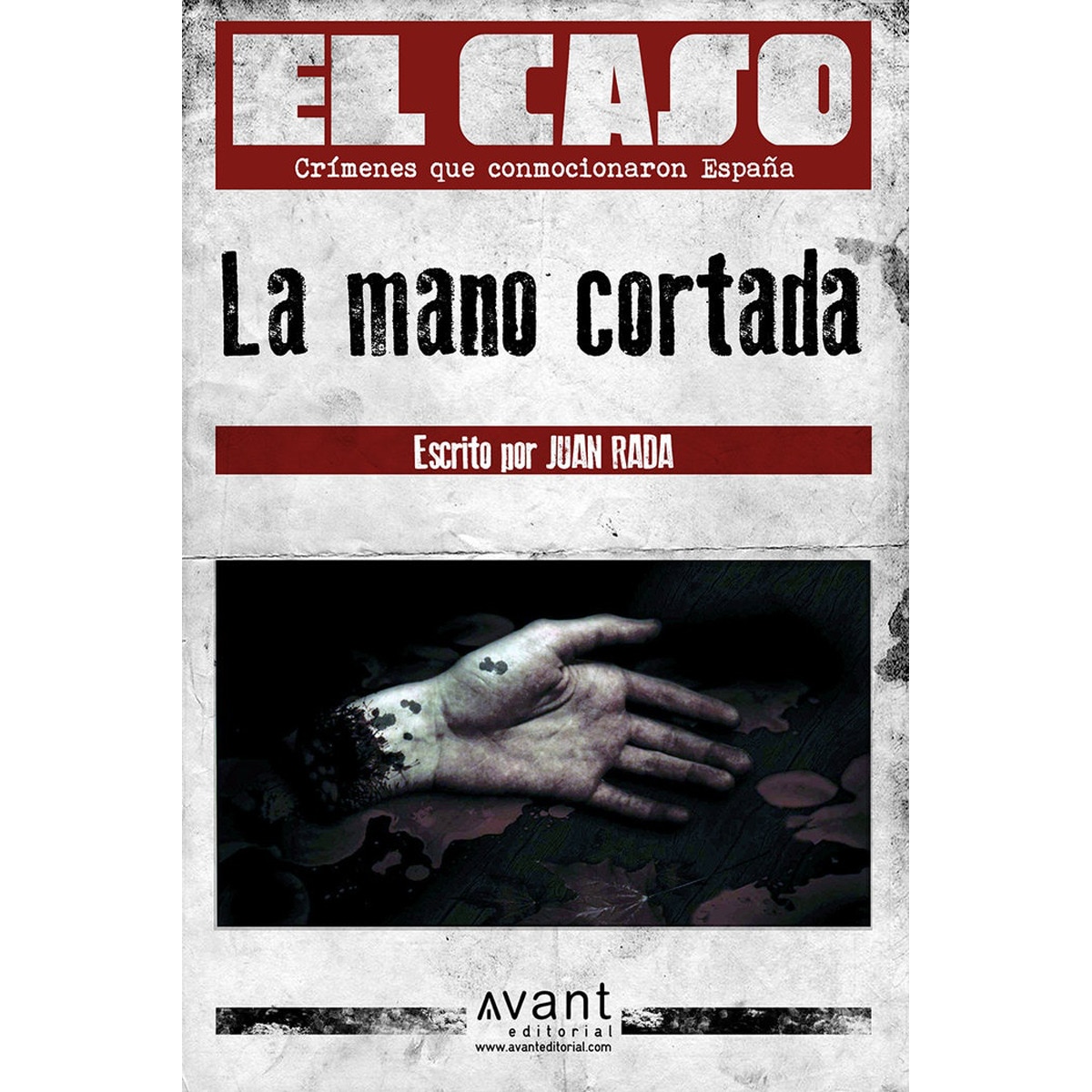 La mano cortada 1