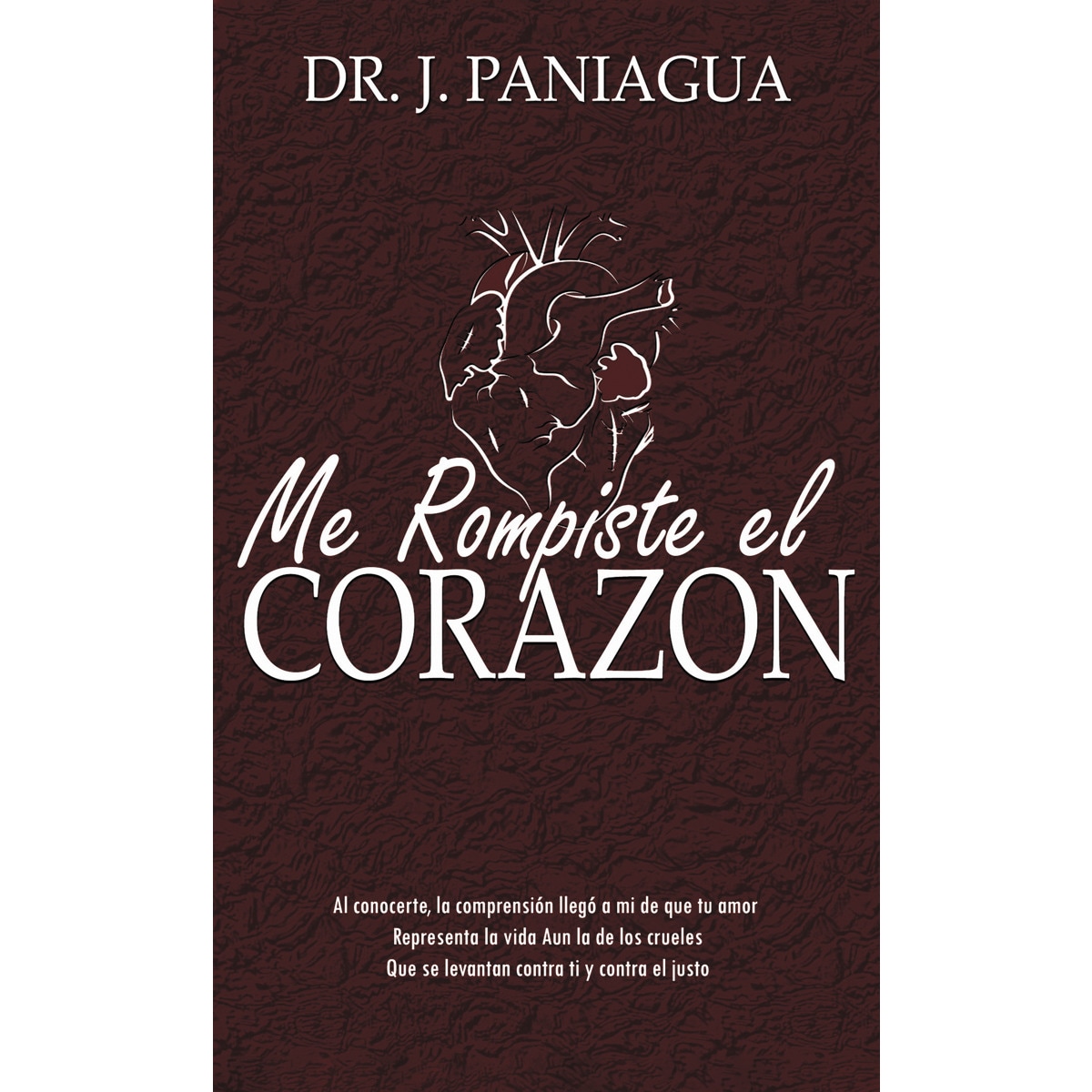 Me rompiste el corazón 1