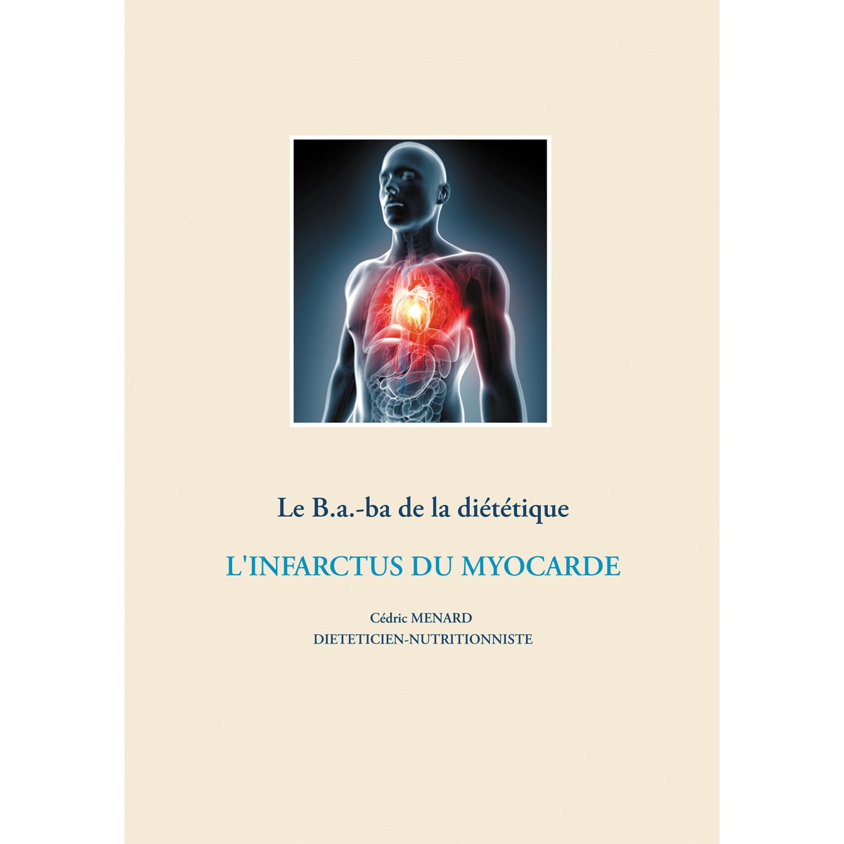 Imagem 0 de Le B.a.-ba de la diététique après un infarctus du myocarde (Capa mole)
