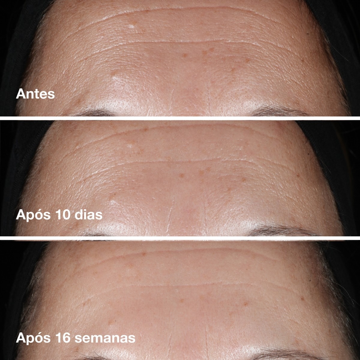 Sérum Smart Clinical Repair™ Wrinkle Correcting Serum 50ml Clinique 3