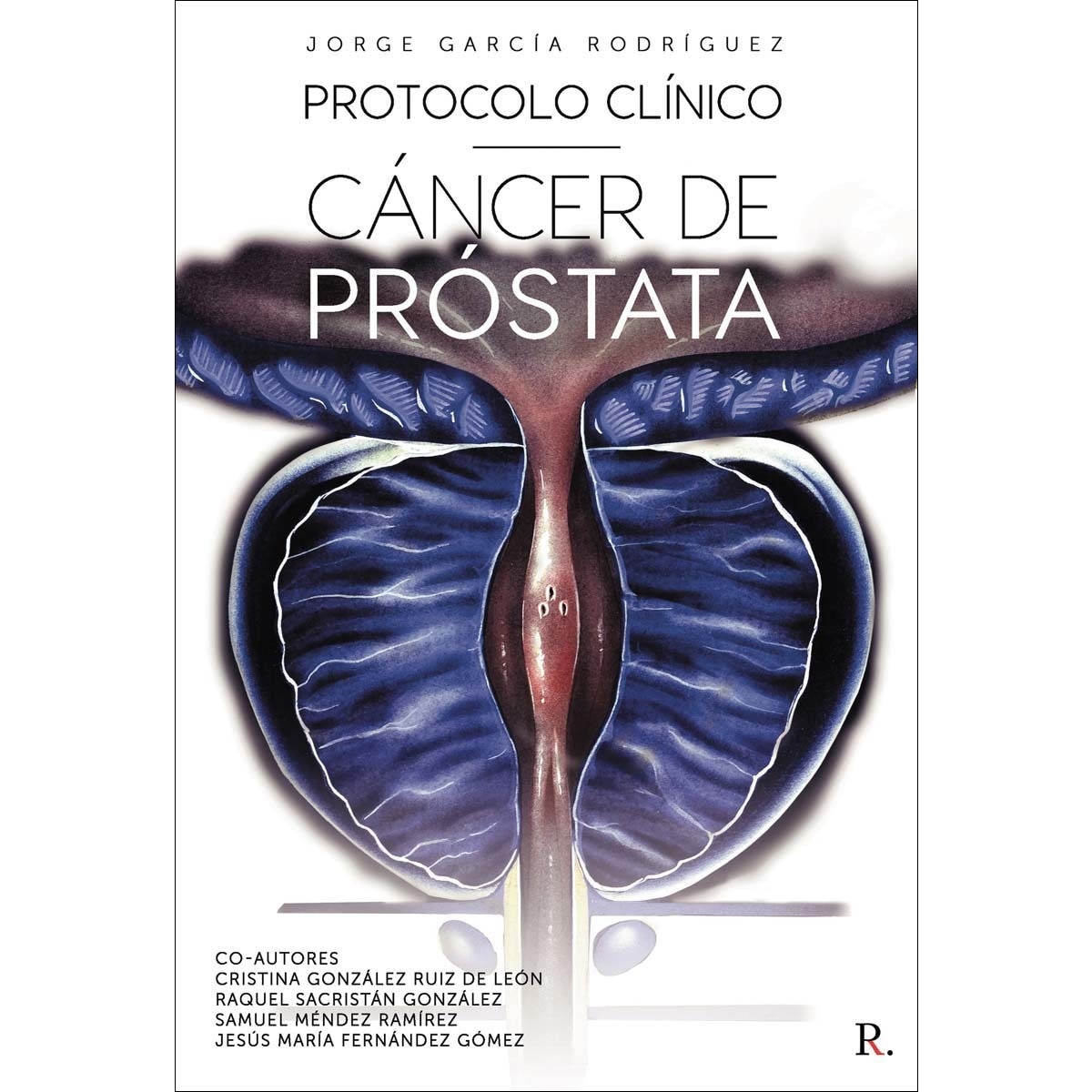 Protocolo clínico cáncer de próstata 1