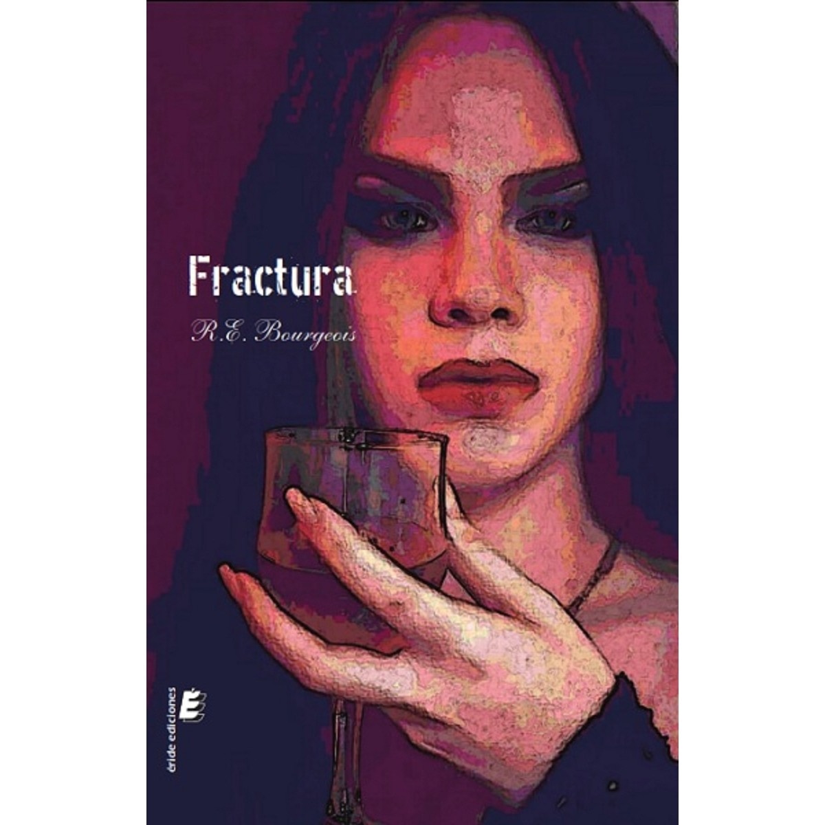 Fractura 1