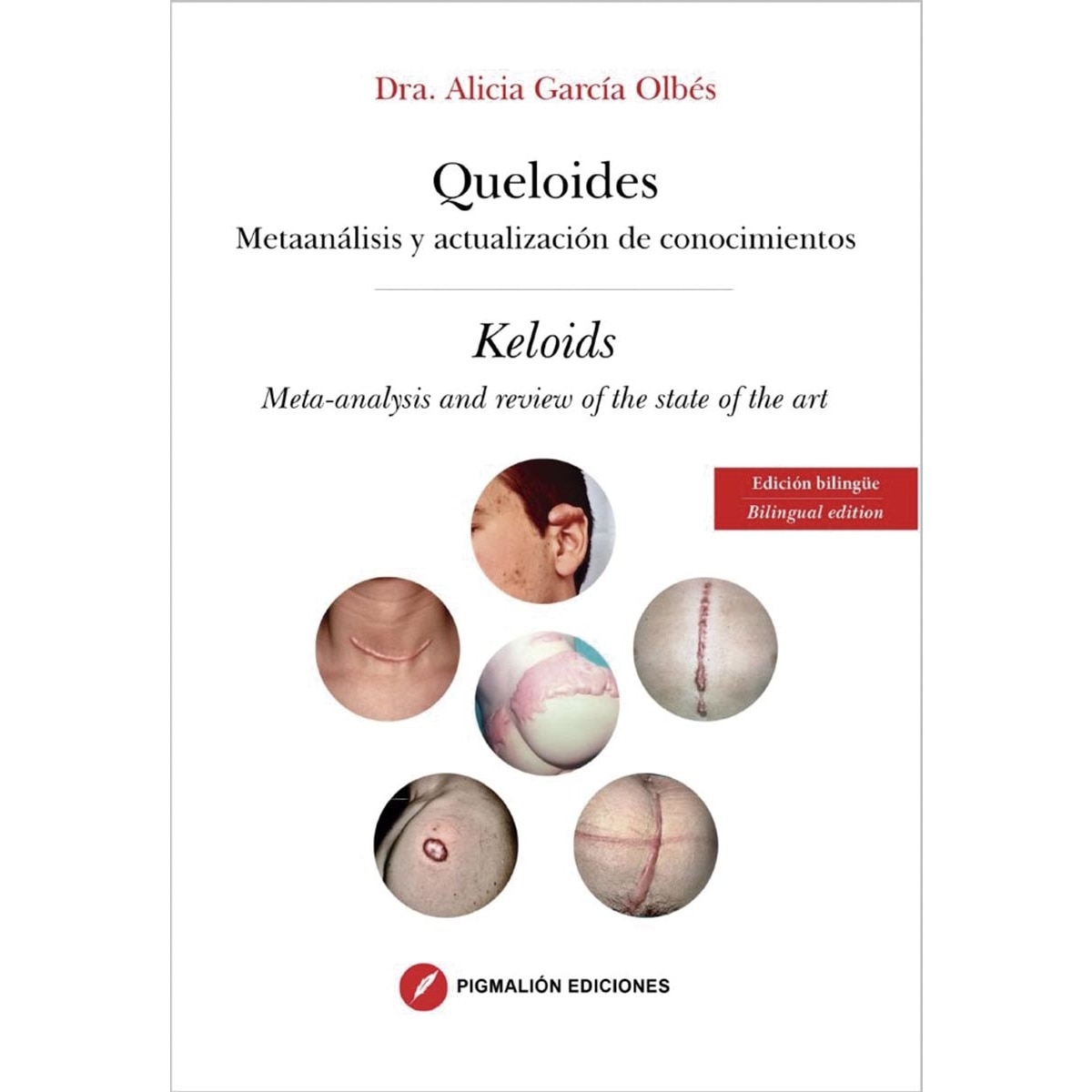 Queloides 1