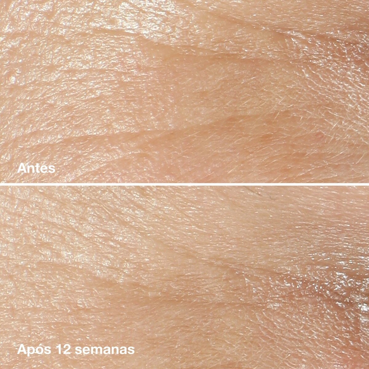 Hidratante Smart Clinical Repair™ Wrinkle Correcting Cream 3