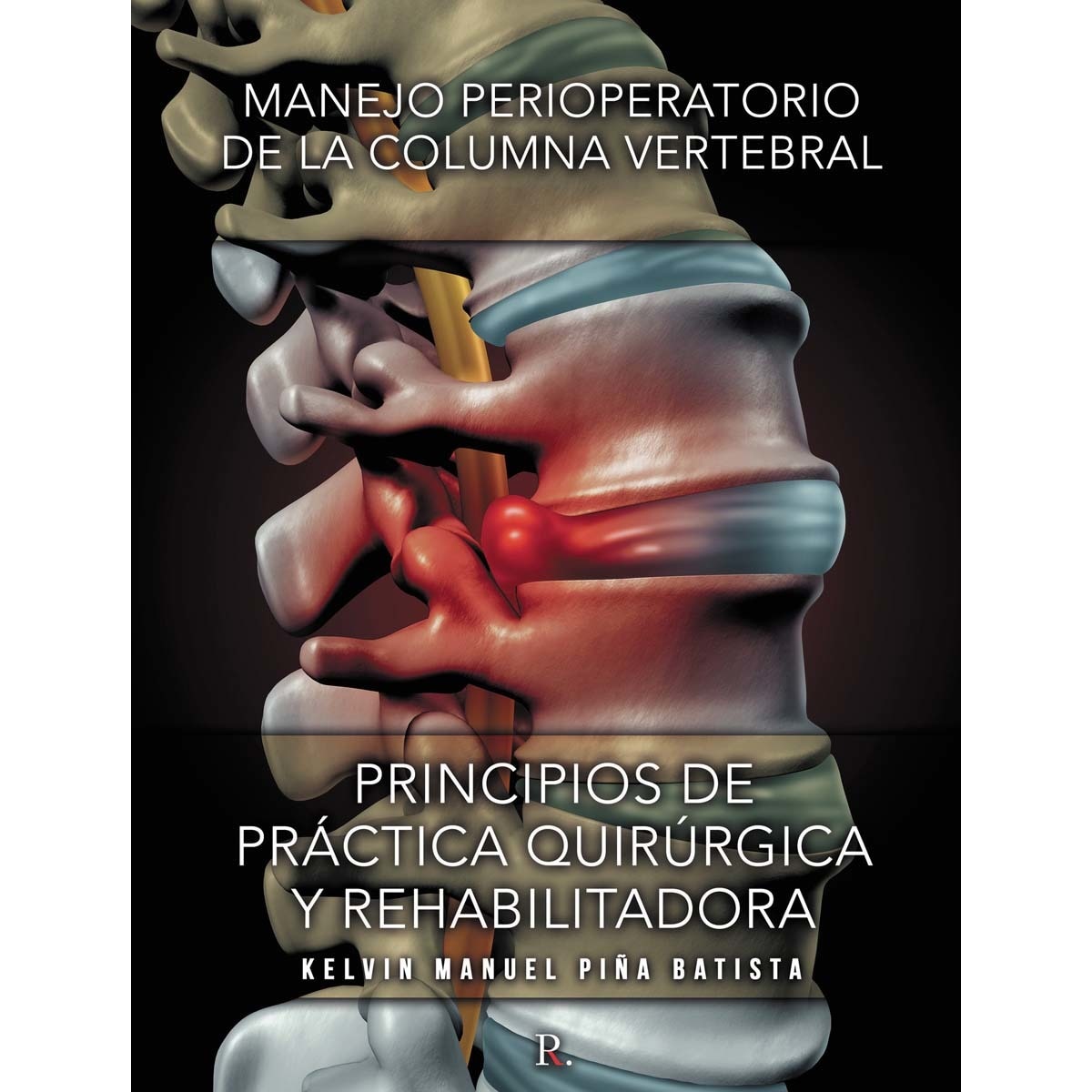 Manejo perioperatorio de la columna 1