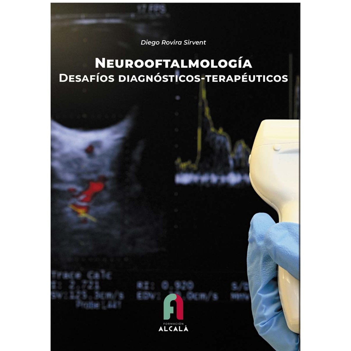 NEUROOFTALMOLOGÍA. DESAFÍOS DIAGNÓSTICOS-TERAPÉUTICOS 1