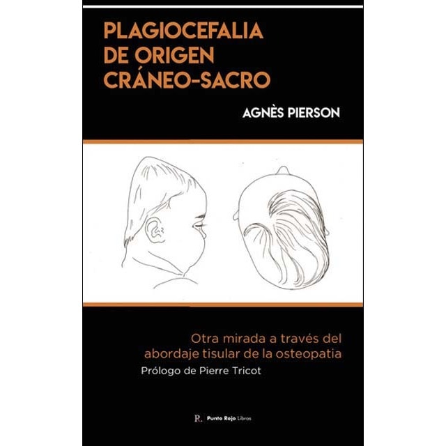 Plagiocefalia de origen cráneo-sacro 1