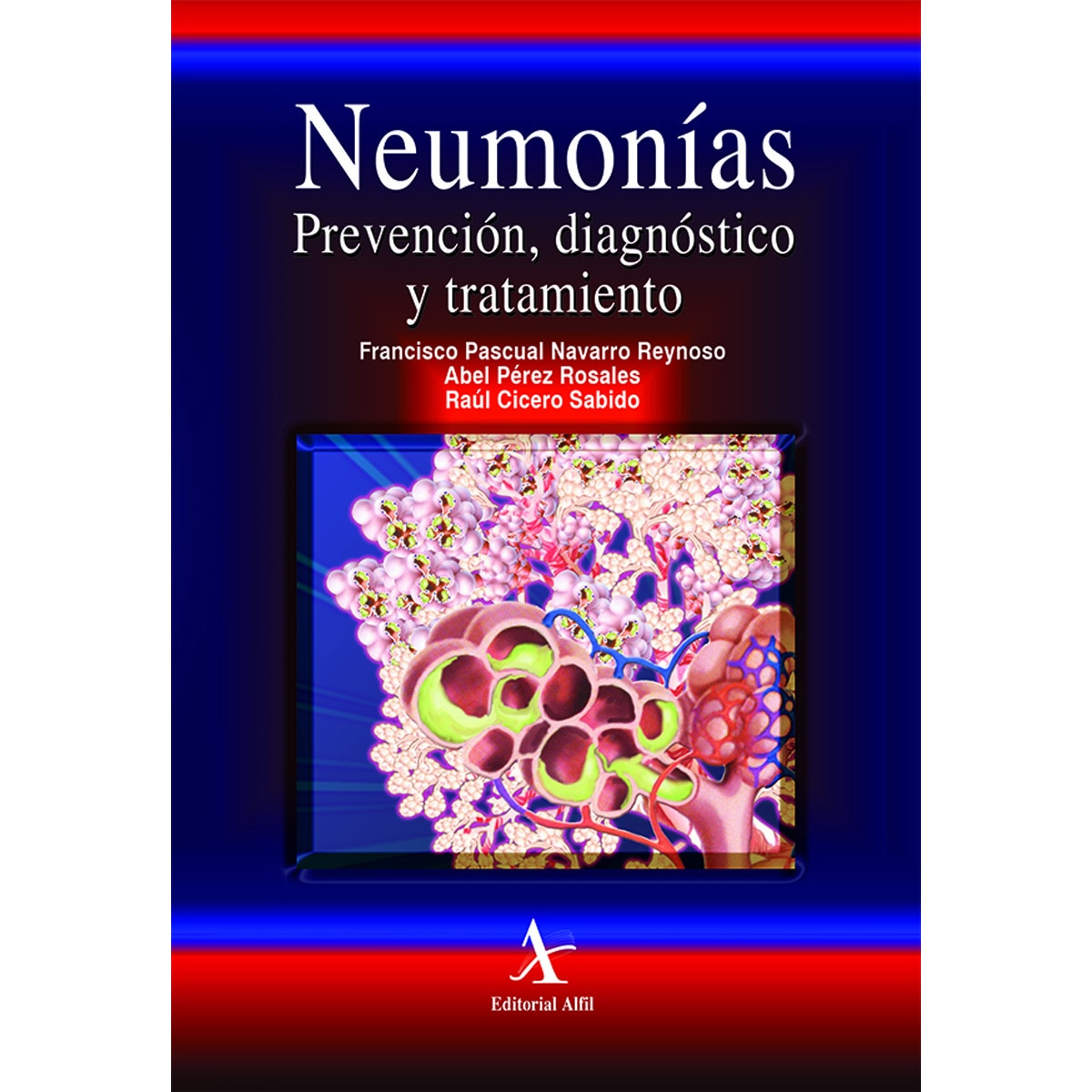 Neumonías 1