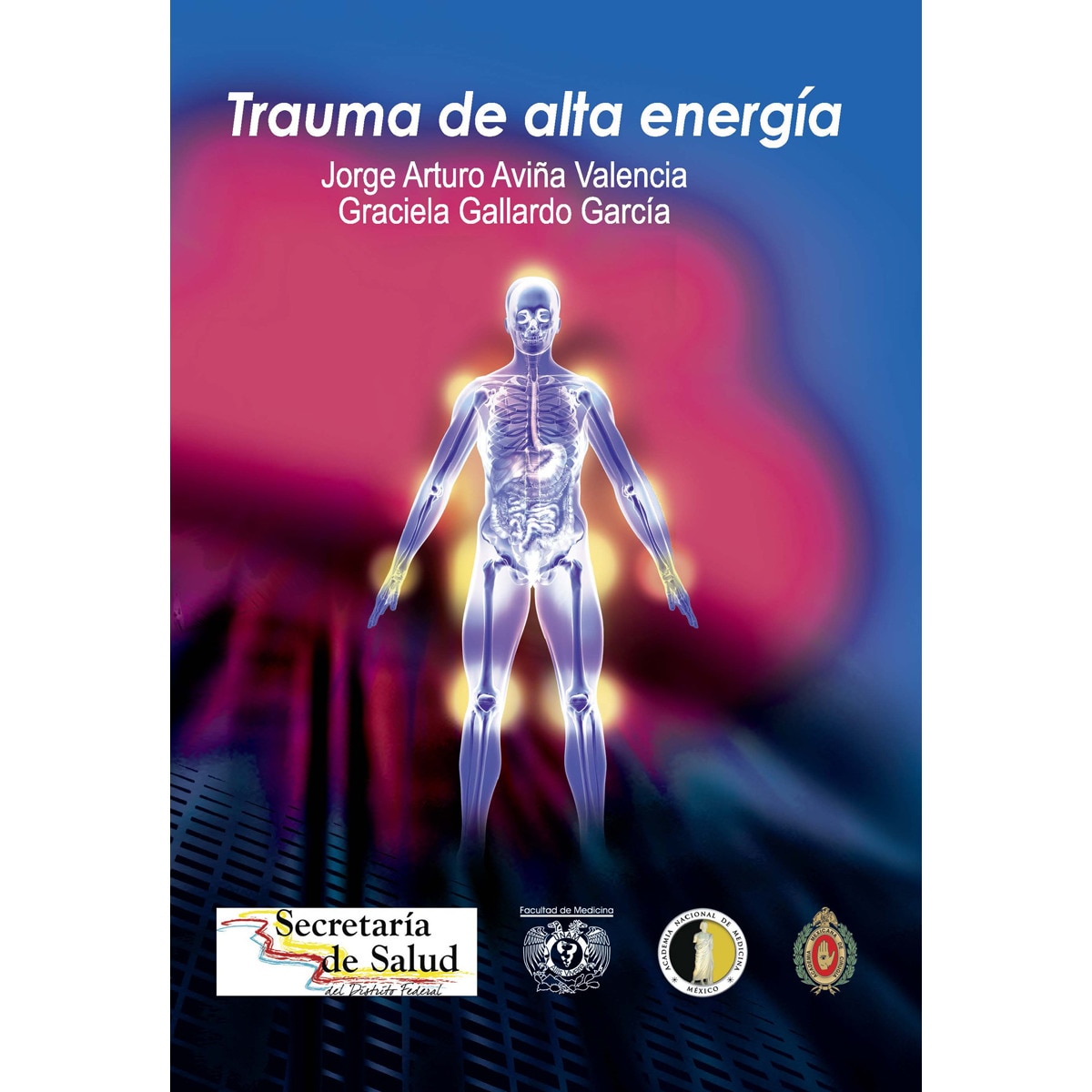 Trauma de alta energía 1