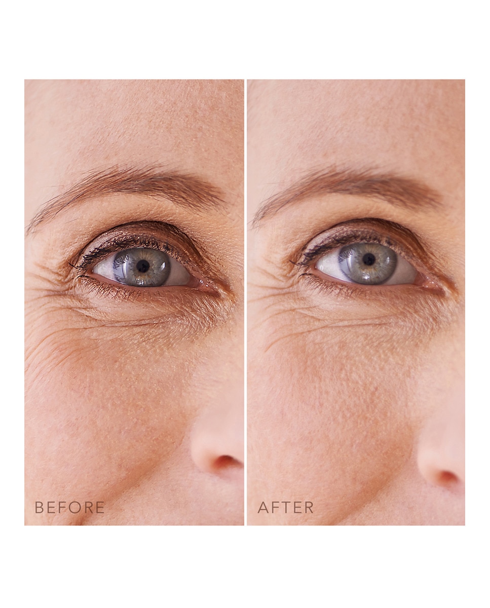 FOREO IRIS™ MASK Mascarilla de hidrogel hidratante para los ojos , con musgo marino y colágeno FOREO 4