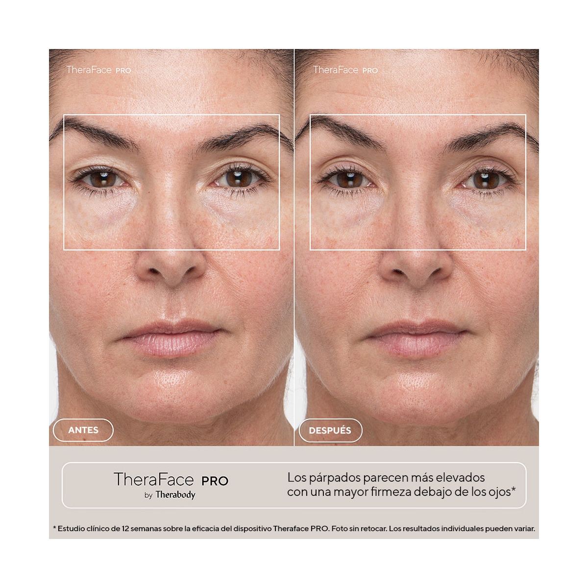 Theraface PRO Dispositivo de Tonificação Facial Preto-19