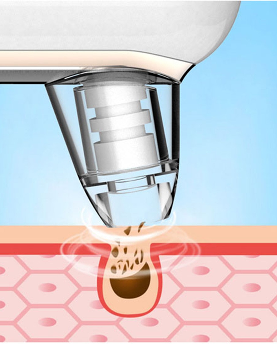 Dispositivo Derma Blush de microdermoabrasión con diamante Beautifly