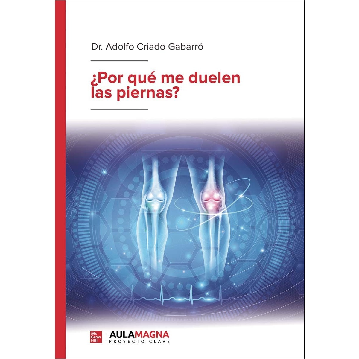 Por qué me duelen las piernas (Capa mole) 1