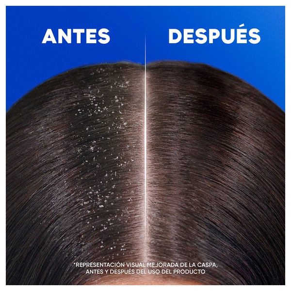 champú anticaspa Classic frasco 625 ml para cabello normal