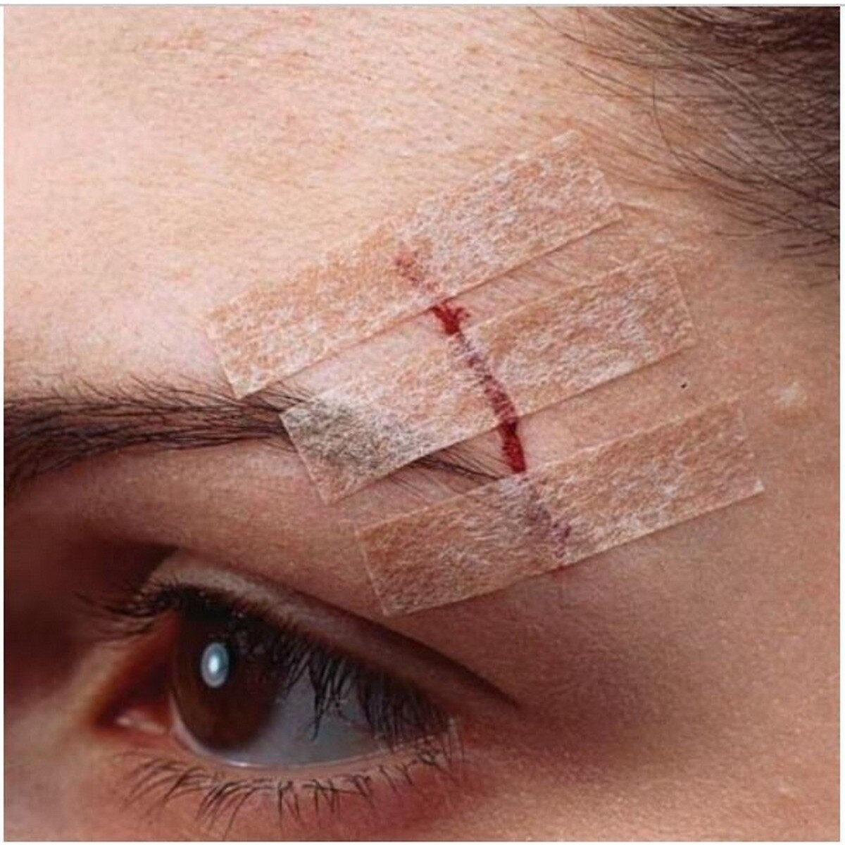 Steri-Strip Suturas Cutâneas Cor de Pele 6 mm x 75 mm - 6 uds. 2