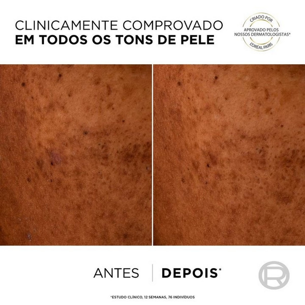 Fluído Hidratante Anti-manchas SPF50+ e Niacinamida Bright Reveal - 50 ml 4