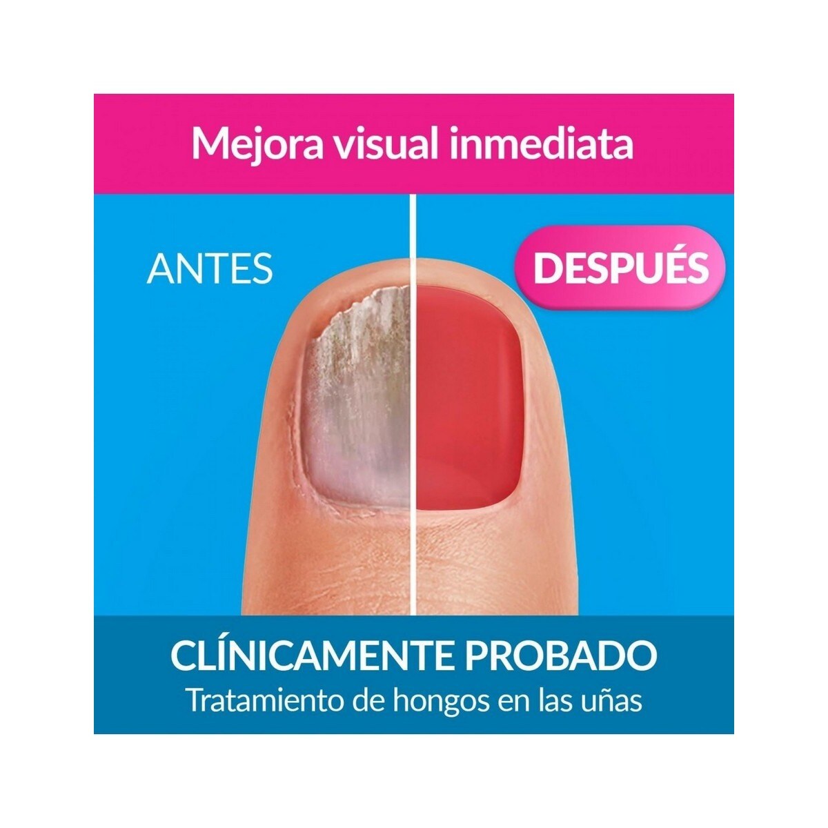 Verniz Excilor Forte em Vermelho - 30 ml 2