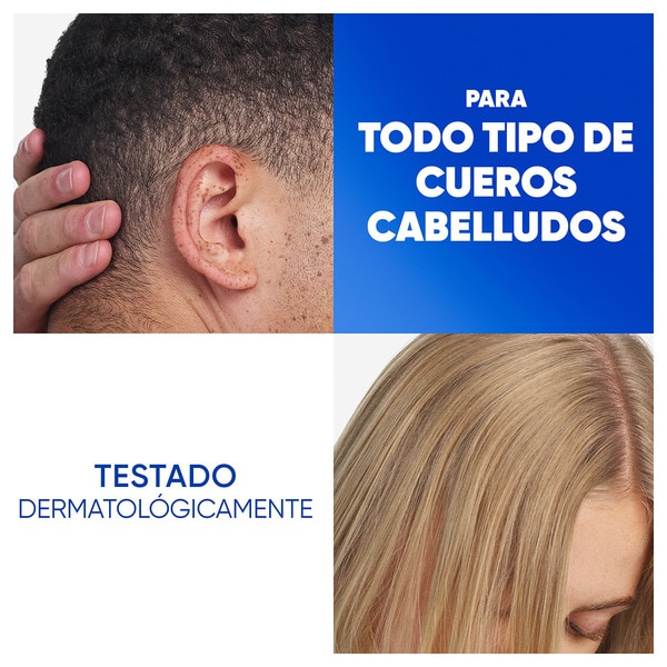 champú anticaspa Citrus Fresh frasco 330 ml para cabello graso