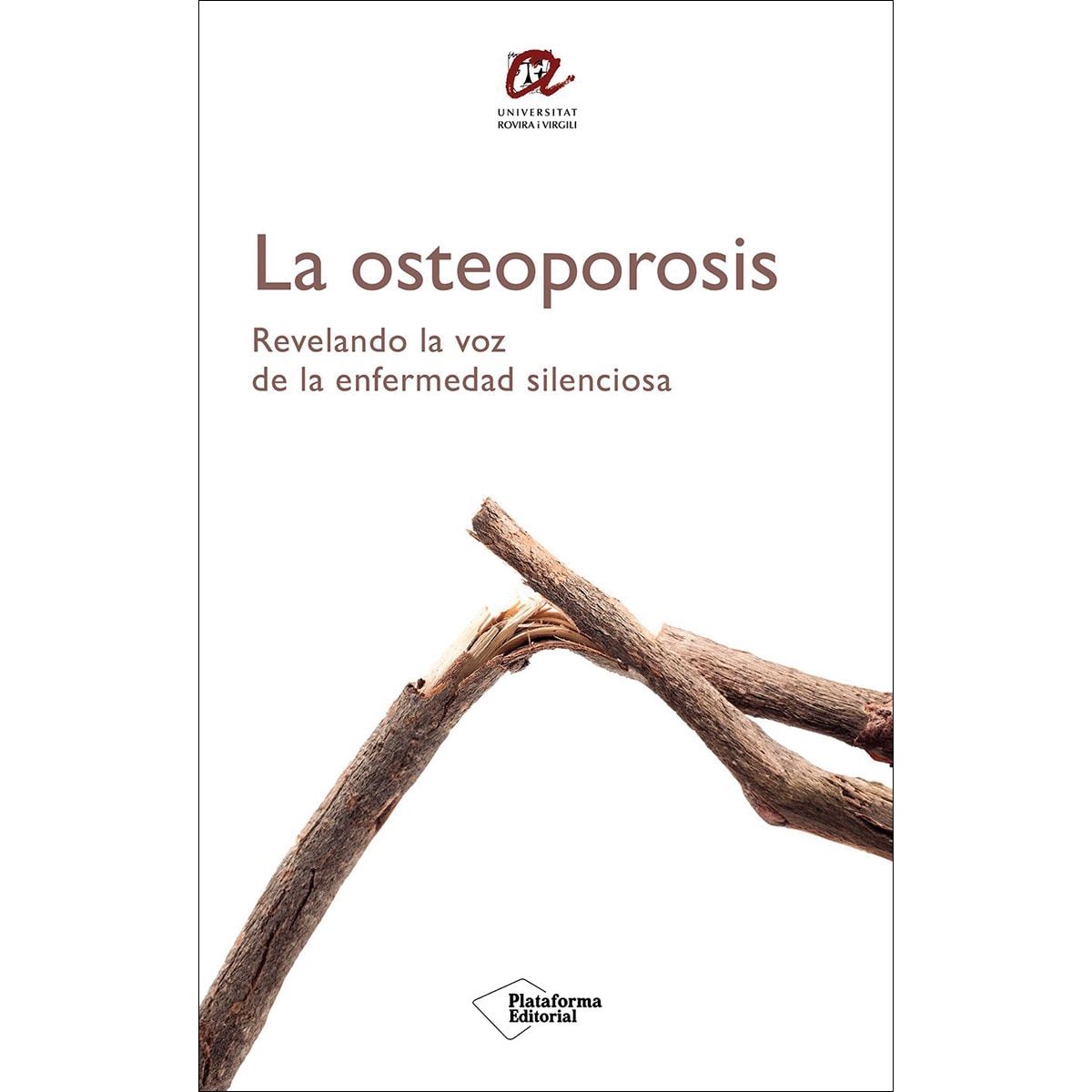 La osteoporosis: Revelando la voz de la enfermedad silenciosa (Capa mole com abas) 1