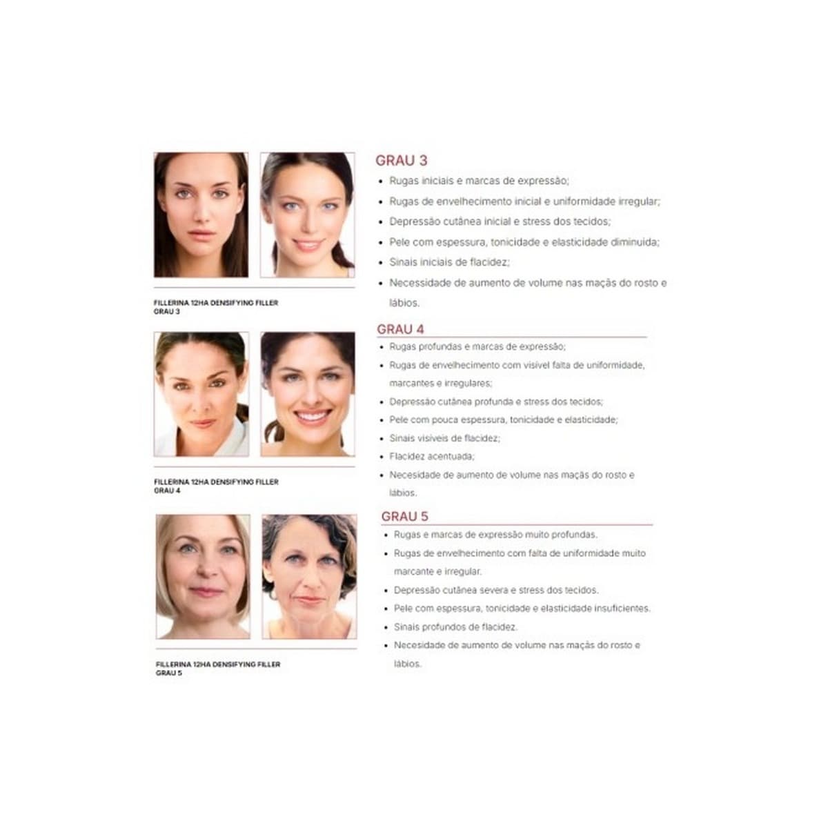Densifying-Filler Tratamento Intensivo Grau 3 4