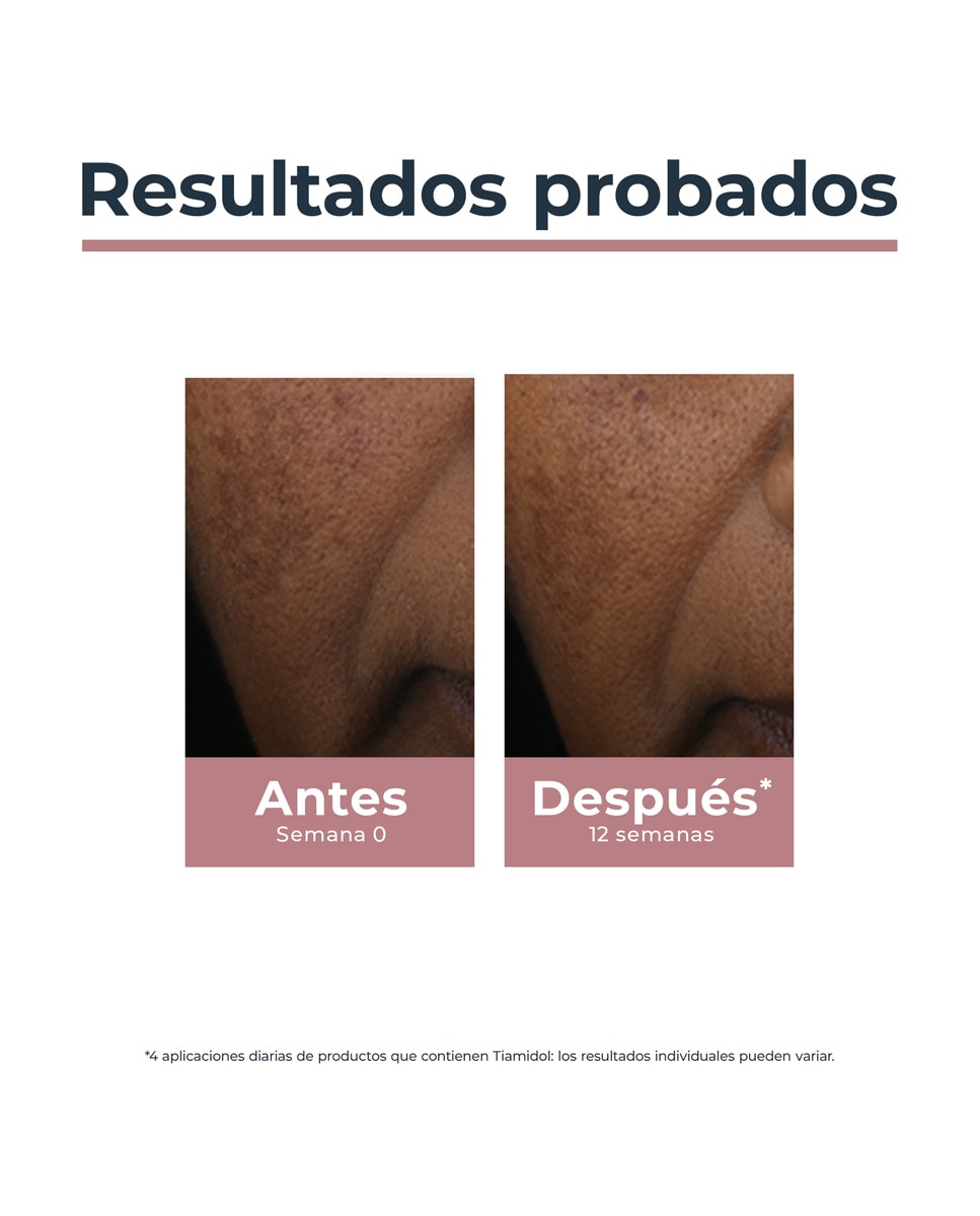Lapiz Corrector de manchas Anti-Pigment 5 ml Eucerin 6