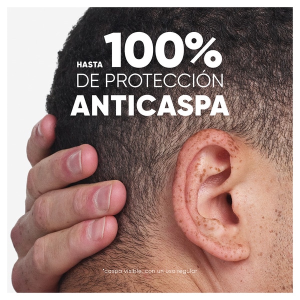 champú y acondicionador anticaspa Todo en 1 Citrus Fresh frasco 300 ml hampú anticaspa Citrus Fresh