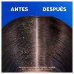 Anti-Schuppen-Shampoo Weich & Seidig Flacon 330 ml