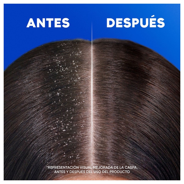 Anti-Schuppen-Shampoo Weich & Seidig Flacon 330 ml