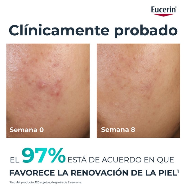 tratamiento de noche para exfoliar y desobstruir los poros Rohr 40 ml